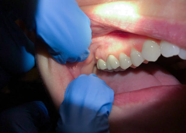 Best Cosmetic Emergency Dentistry in Lancaster, SC