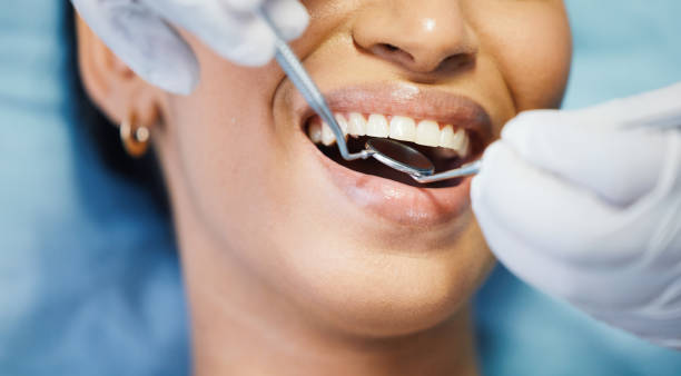 Best Emergency Treatment for Dental Infections or Abscesses in Lancaster, SC