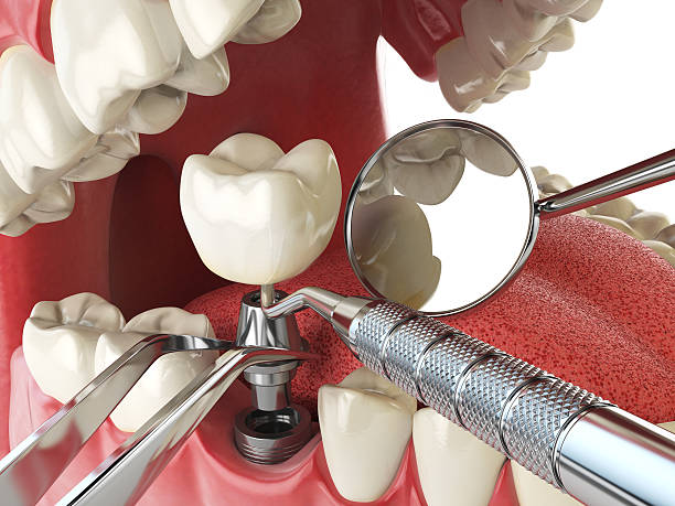 Best Cosmetic Emergency Dentistry in Lancaster, SC